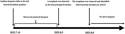 Nocardia farcinica infection presenting as a solitary bronchial neoplasm in an immunocompetent adult: a case report